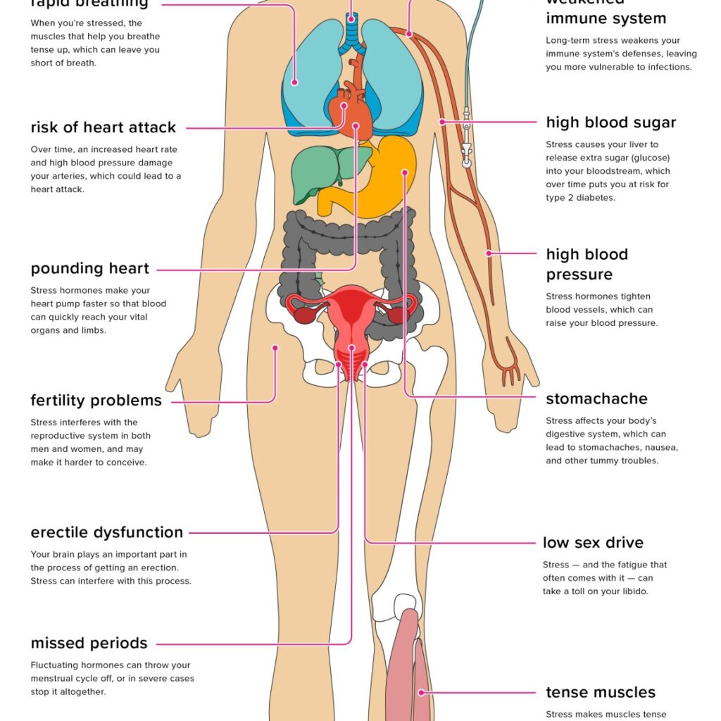 Stress Relief and Mental Wellness: Understanding Causes, Effects, and Effective Strategies