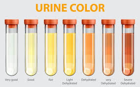 Urine Examination: Modern and Ayurvedic Aspects