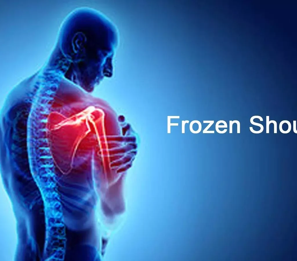 Frozen shoulder ayurvedic and modern aspects