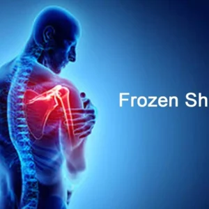 Frozen shoulder ayurvedic and modern aspects